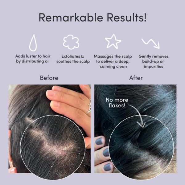 71H2EMtfCML._SL1500_.jpg Jupiter Exfoliator Brush, for Removing Dandruff & Build-Up, Detangling Scrubber, for Wet or Dry Hair, Supports Circulation & Growth, for All Hair Types, Black