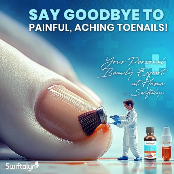Fungal Nail Treatment for Toenalis and Fingernails: Nail Fungus Treatment for Thick, Discolored, Brittle Nails – Helps Improve Nail Appearance and Supports Healthy Growth