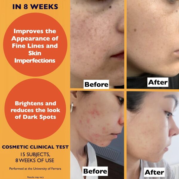 Big 2.11oz. Organic Vitamin C Serum for Face with Hyaluronic Acid & Niacinamide. Anti-Dark Spots, Wrinkle, Aging Brightening Facial and Eye Contour Vitamin C Serum. Brightening Women and Men Skin Care