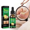 7 Days Nail Fungus Treatment Toenail Fungus Treatment Extra Strength-Ginger Nail Treatment,Toenail Cuticle Care Oil Care,Multi-Purpose Nail Repair for Your nails a Natural Shine (1)