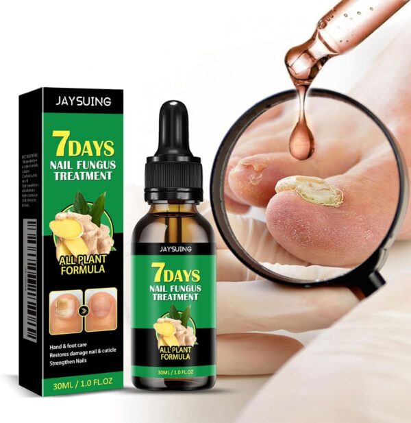 7 Days Nail Fungus Treatment Toenail Fungus Treatment Extra Strength-Ginger Nail Treatment,Toenail Cuticle Care Oil Care,Multi-Purpose Nail Repair for Your nails a Natural Shine (1)