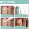 Nail Care Pens, 2Pcs Fungal Nail Treatment Pen, Fungal Nail Treatment for Toenails, Nail Repair Pen, Natural Ingredients Nail Serum for Strengthener Nail