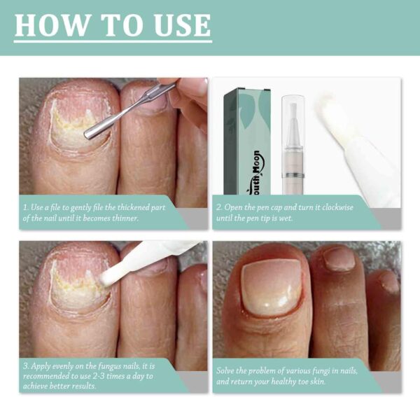 Nail Care Pens, 2Pcs Fungal Nail Treatment Pen, Fungal Nail Treatment for Toenails, Nail Repair Pen, Natural Ingredients Nail Serum for Strengthener Nail