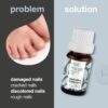 Nail Repair Oil with Natural 4-Terpineol Known from Tea Tree Oil – Treats Cracked, Rough, and Discolored Nails for Strong, Healthy Nails