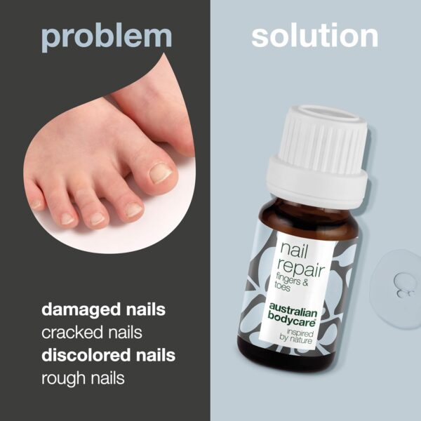 Nail Repair Oil with Natural 4-Terpineol Known from Tea Tree Oil – Treats Cracked, Rough, and Discolored Nails for Strong, Healthy Nails