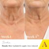 Absolute Collagen Deep Lift Neck & Decollete Cream 50ml - Collagen Boosting Anti-Ageing Formula - Visibly Reduces Appearance of Fine Lines and Wrinkles - Smoother, Firmer & Sculpted Skin