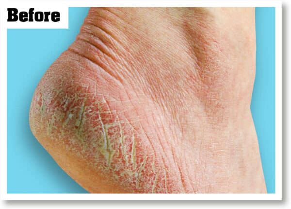 71JXwiVP-KL._AC_SL1500_.jpg O'Keeffe's Healthy Feet, 91g, Packaging may vary