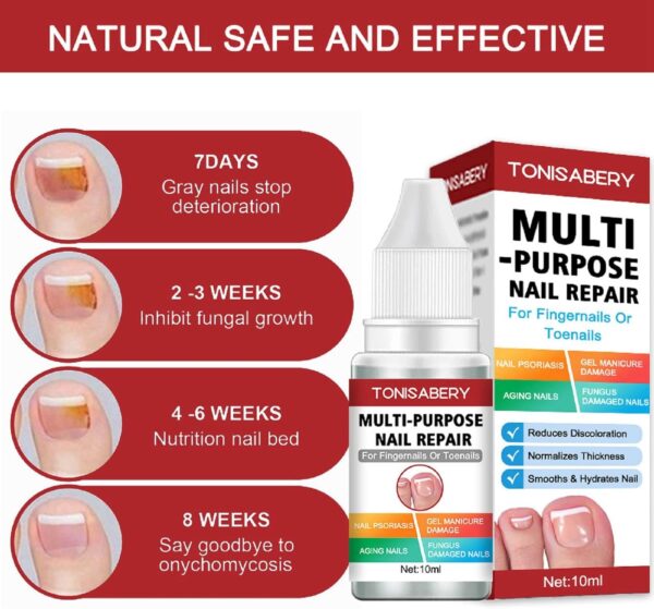AINxtolm Fungal Nail Treatment,Nail Fungus Treatment Toenail,Toe Nail,Toenail Fungus Treatment,Fungal Nail Treatment Toenails Extra Strong,Fingernail Toenail Care Nail Repair, red, 10 millilitre