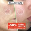 Big 2.11oz. Organic Vitamin C Serum for Face with Hyaluronic Acid & Niacinamide. Anti-Dark Spots, Wrinkle, Aging Brightening Facial and Eye Contour Vitamin C Serum. Brightening Women and Men Skin Care