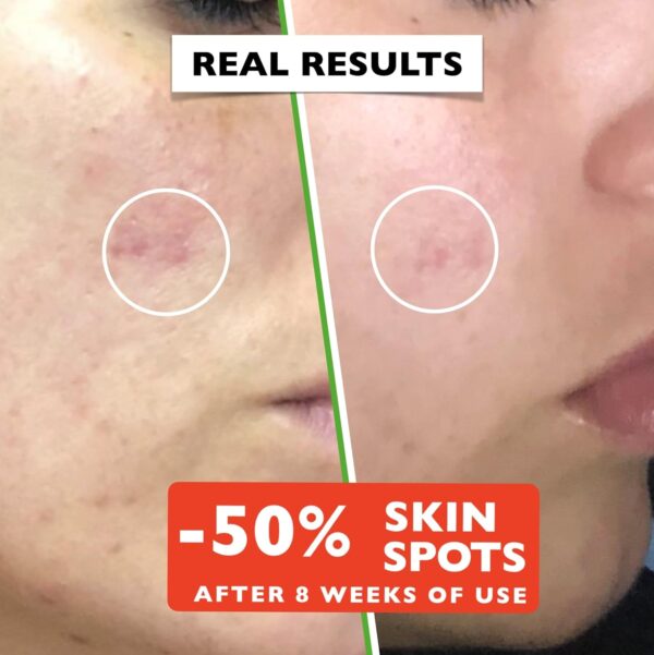 Big 2.11oz. Organic Vitamin C Serum for Face with Hyaluronic Acid & Niacinamide. Anti-Dark Spots, Wrinkle, Aging Brightening Facial and Eye Contour Vitamin C Serum. Brightening Women and Men Skin Care