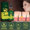 71Ng1gtZtL._AC_SL1500_.jpg Ginger Anti Hair Loss 7 Days Oil,Ginger Hair Growth Oil,Hair Loss Treatment for Women,Hair Growth Serum,Repair Damaged Hair,Ginger Hair Growth Germinal Oil,Hair Strengthening Products,Hair Thickening