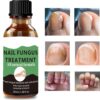 Nail Fungus Treatment For Toenail - Extra Strong Fungal Nail Treatment - Anti fungus Nail Repair and Strengthen, Fix & Renew Damaged, Broken Nails （2PC）