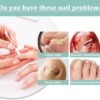 Fungal Nail Treatment Pen for Toenails and Fingernails, Toenail Fungus Treatment Pen, Fungal Nail treatment Extra Strong, Anti Fungus Nail Strengthener for Ingrown & Thick Nail Infection Treatment (1)