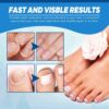 Ginger Nail Treatment Nail Support Nail Care,Fungal Nail Treatment,Ginger N/ail Growth Treatment Serum,7 D/ays Na/il Treatment,Na/il Strengthener for Damaged Nails,Nai/l Hardener,Nai/l Repair