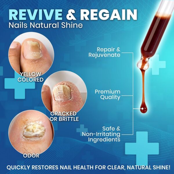Fungal Nail Treatment for Toenalis and Fingernails: Nail Fungus Treatment for Thick, Discolored, Brittle Nails – Helps Improve Nail Appearance and Supports Healthy Growth