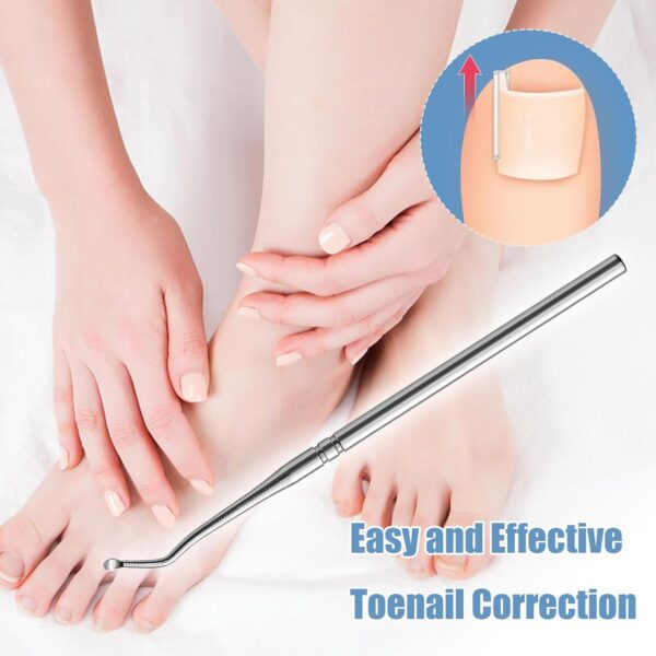 40 Pcs Toenail Correction Patch,Ingrown Toenail Corrector Set,Pain-Free Toenail Straightener Strips with Toenail Lifter,Toenail Correction for Ingrown Toenails for Women Men Foot Care
