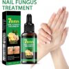 Nail Fungus Treatment, Ginger Nail Fungus Treatment,Toenail Cuticle Care Oil Care, Multi-Purpose Nail Repair for Your nails a Natural Shine (2 Pcs)
