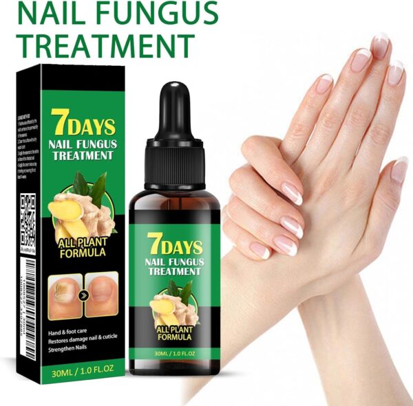 Nail Fungus Treatment, Ginger Nail Fungus Treatment,Toenail Cuticle Care Oil Care, Multi-Purpose Nail Repair for Your nails a Natural Shine (2 Pcs)