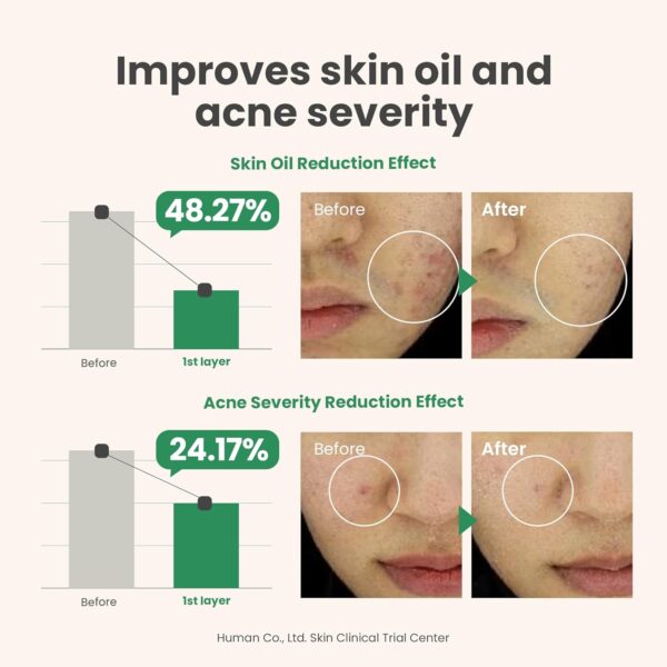 [AXIS-Y] Spot the Difference Blemish Treatment 15ml