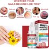AINxtolm Fungal Nail Treatment,Nail Fungus Treatment Toenail,Toe Nail,Toenail Fungus Treatment,Fungal Nail Treatment Toenails Extra Strong,Fingernail Toenail Care Nail Repair, red, 10 millilitre