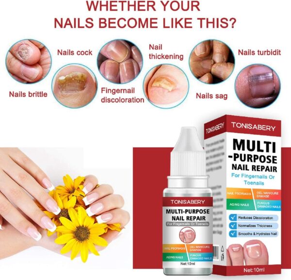 AINxtolm Fungal Nail Treatment,Nail Fungus Treatment Toenail,Toe Nail,Toenail Fungus Treatment,Fungal Nail Treatment Toenails Extra Strong,Fingernail Toenail Care Nail Repair, red, 10 millilitre
