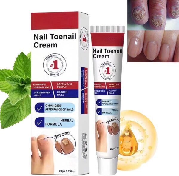Fungal Nail Treatment Cream,Antifungal Nail Polish Cream,Nail Fungus Treatment for Toenail,Strong Anti-Fungal Toenail Cream,Nail Improve Cream,Nail Repair Cream for Thick Cracked Discolored Nails