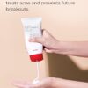 COSRX AC Collection Calming Foam Cleanser, 150ml / 5.07 fl.oz | Salicylic Acid Acne Cleanser | Animal Testing Free, Paraben Free, Korean Skin Care