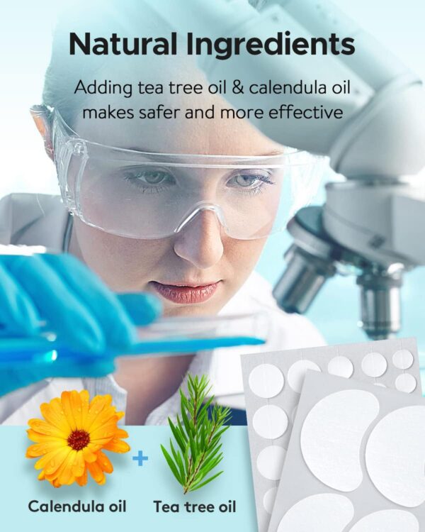 71Twxmb1hQL._AC_SL1500_.jpg LitBear 84 Patches 5 Size Acne Patches Large, Hydrocolloid Pimple Patches for Large Breakouts, Zit and Blemish, Large Acne Patches for Face, Chin, Back and Body with Tea Tree Oil