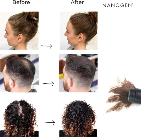 Nanogen Hair Fibres, 30 g, Dark Brown