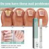 Nail Care Pens, 2Pcs Fungal Nail Treatment Pen, Fungal Nail Treatment for Toenails, Nail Repair Pen, Natural Ingredients Nail Serum for Strengthener Nail