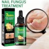 Nail Fungus Treatment, Ginger Nail Fungus Treatment,Toenail Cuticle Care Oil Care, Multi-Purpose Nail Repair for Your nails a Natural Shine (2 Pcs)