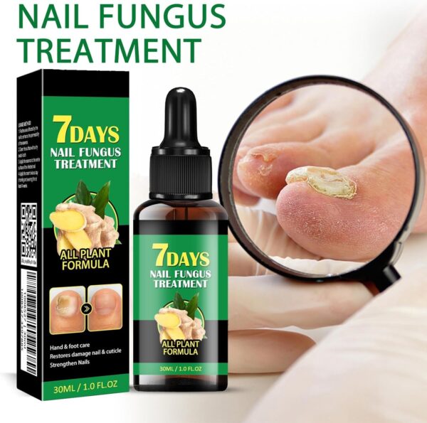 Nail Fungus Treatment, Ginger Nail Fungus Treatment,Toenail Cuticle Care Oil Care, Multi-Purpose Nail Repair for Your nails a Natural Shine (2 Pcs)