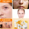 Xumann 7PCS Vitamin C Skincare Gift Set for Teen Girl, Skin Care for Teenage, Cleanser Toner Moisturiser Set for Women