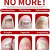 7 Days Nail Fungus Treatment Toenail Fungus Treatment Extra Strength-Ginger Nail Treatment,Toenail Cuticle Care Oil Care,Multi-Purpose Nail Repair for Your nails a Natural Shine (1)