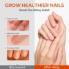 Modelones Nail Biting Treatment, No Bite Nail Polish, Thumb Sucking Deterrent, Promotes Fast Nail Growth, Stop Nail Biting, Easy Application, Quick-Drying Bitter Nail Polish 15 ML