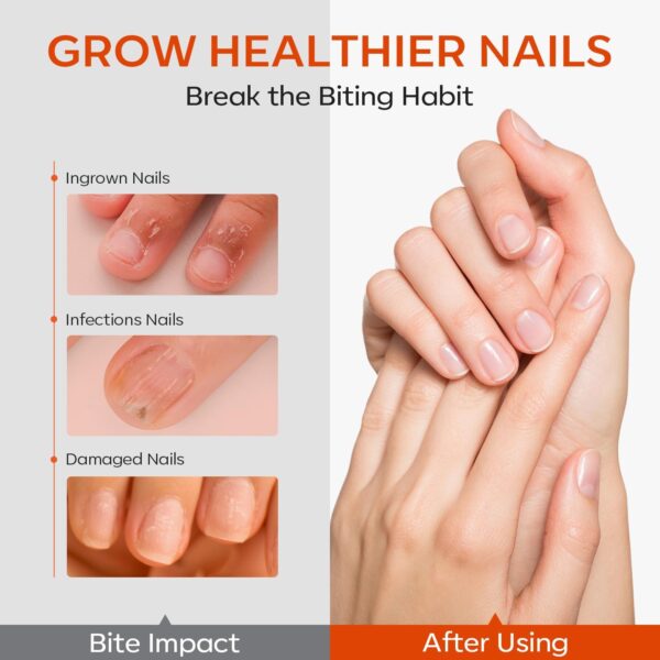 Modelones Nail Biting Treatment, No Bite Nail Polish, Thumb Sucking Deterrent, Promotes Fast Nail Growth, Stop Nail Biting, Easy Application, Quick-Drying Bitter Nail Polish 15 ML