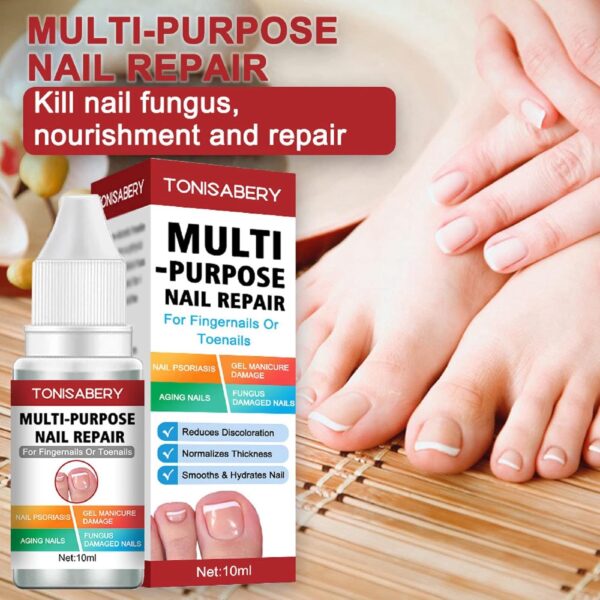 AINxtolm Fungal Nail Treatment,Nail Fungus Treatment Toenail,Toe Nail,Toenail Fungus Treatment,Fungal Nail Treatment Toenails Extra Strong,Fingernail Toenail Care Nail Repair, red, 10 millilitre