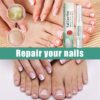 2PCS Nail Care Pen,Fungal Nail Treatment Pen,Cosmetic Care for Nail Fungus,Toenail Fungus Treatment Pen,Fungal Toenail Treatment,Antifungal Nail Polish,Nail Repair Pen for Nail