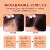 Raw Batana Oil for Hair Growth - 100% Pure, Organic 4oz Batana from Honduras for Thick and Strong Natural Hair - Dr. Sebi Unrefined Cold Pressed Cosmetic Scalp Mask for Men & Women (1 Pack)