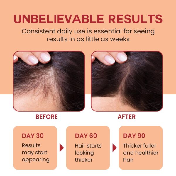 Raw Batana Oil for Hair Growth - 100% Pure, Organic 4oz Batana from Honduras for Thick and Strong Natural Hair - Dr. Sebi Unrefined Cold Pressed Cosmetic Scalp Mask for Men & Women (1 Pack)