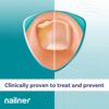 Nailner Fungal Nail Brush 5 ml - Treat & Prevent Fungal Nail Infection - Anti Fungal Nail Treatment for Toenails - Clinically proven - 300 Applications - Clear