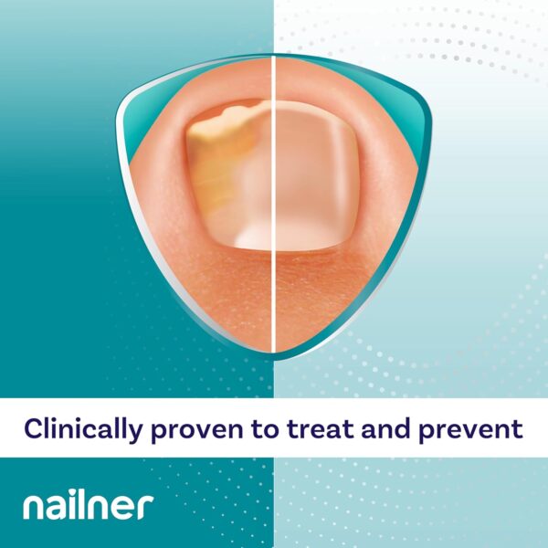 Nailner Fungal Nail Brush 5 ml - Treat & Prevent Fungal Nail Infection - Anti Fungal Nail Treatment for Toenails - Clinically proven - 300 Applications - Clear