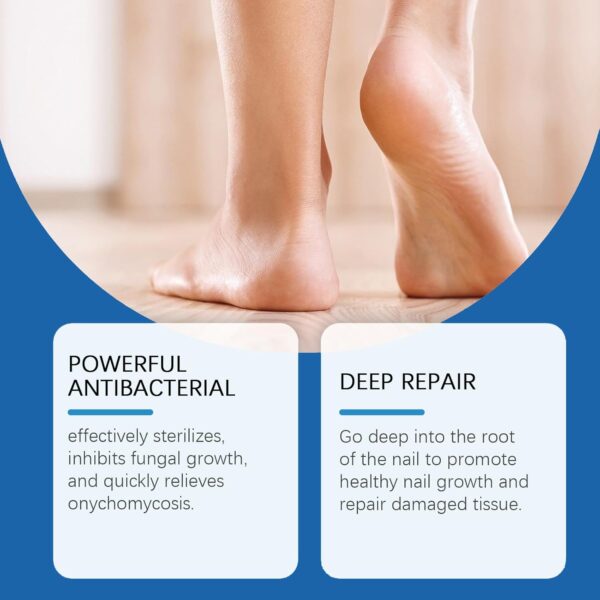 JORUN 2 Pcs Fungal Nail Treatment for Toenails Extra Strong Nail Care Serum - Natural 60 Ml Toe Nail Fungal Treatment - No Stimulation Nail Growth Treatment for Broken,Discolored Fungal Nail