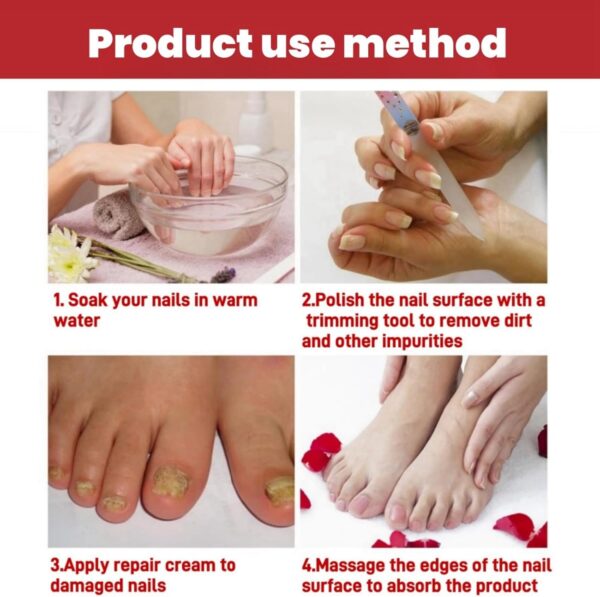 Fungal Nail Treatment Cream,Antifungal Nail Polish Cream,Nail Fungus Treatment for Toenail,Strong Anti-Fungal Toenail Cream,Nail Improve Cream,Nail Repair Cream for Thick Cracked Discolored Nails