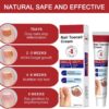 Fungal Nail Treatment Cream,Antifungal Nail Polish Cream,Nail Fungus Treatment for Toenail,Strong Anti-Fungal Toenail Cream,Nail Improve Cream,Nail Repair Cream for Thick Cracked Discolored Nails