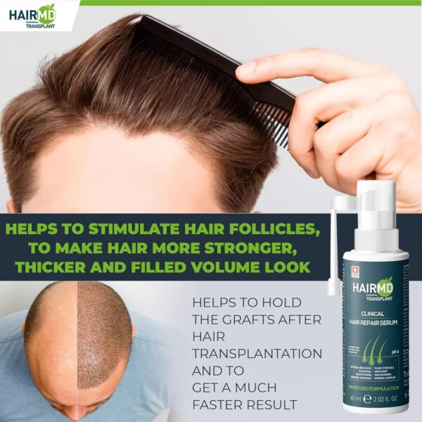 HairMD Transplant Clinical Repair Serum - 60ml Hair Regrowth Serum - Prevents Post-Transplant Hair Loss - Stimulates New Hair Growth - Fast and Effective Results - Gentle Formula