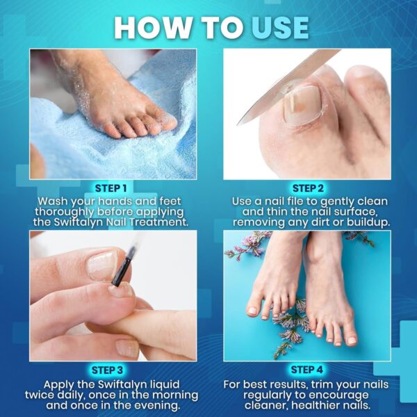 Fungal Nail Treatment for Toenalis and Fingernails: Nail Fungus Treatment for Thick, Discolored, Brittle Nails – Helps Improve Nail Appearance and Supports Healthy Growth