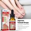 Ingrown Toenail Treatment - 30ml Ingrown Toenail - Cuticle Care Oils for Ingrown Toenails - Trimming Toenail Softening Drops Natural Ingrown Toenail Correction Treatment Fungal Nail Treatment