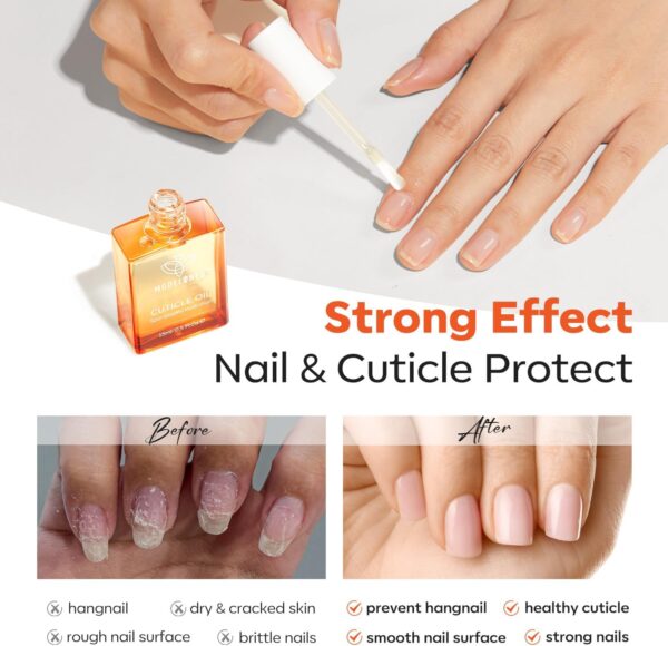 Modelones Nail Strengthener and Cuticle Oil Nail Care 8 in one Ridge Filling Nail Repair Kit Nail Growth Treatment for Thin& Damaged Nails, Moisturizes Dry Skin, Repairs Cuticles Nail Growth Oil 15ml