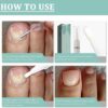 Fungal Nail Treatment Pen for Toenails and Fingernails, Toenail Fungus Treatment Pen, Fungal Nail treatment Extra Strong, Anti Fungus Nail Strengthener for Ingrown & Thick Nail Infection Treatment (1)